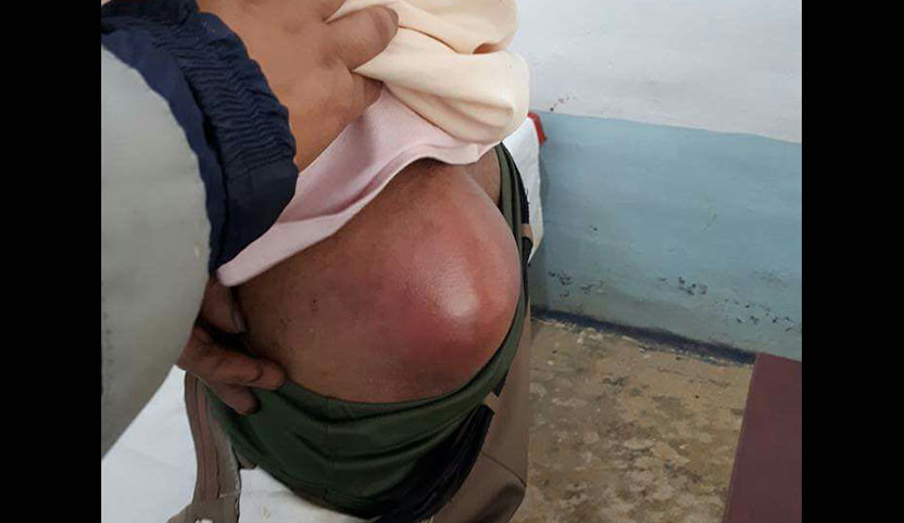 Falso medicamento manda al hospital a pobladores de la Sierra Mazateca, Oaxaca