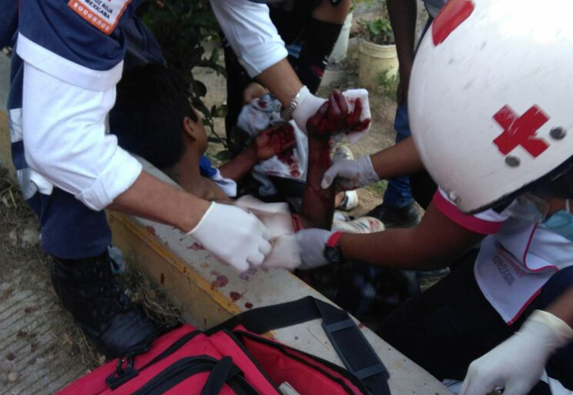 En Oaxaca, atacan a joven a machetazos por ahuyentar a un perro a pedradas | El Imparcial de Oaxaca En Oaxaca, atacan a joven a machetazos por ahuyentar a un perro a pedradas | El Imparcial de Oaxaca