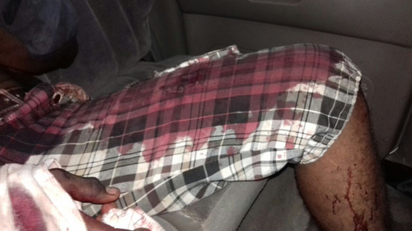 Trágico desenlace de una fiesta en Pinotepa Nacional, Oaxaca | El Imparcial de Oaxaca Trágico desenlace de una fiesta en Pinotepa Nacional, Oaxaca | El Imparcial de Oaxaca
