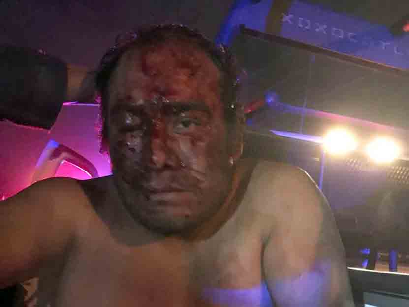 Olvidó sus llaves, saltó su barda y lo tunden a golpes en Xoxocotlán, Oaxaca | El Imparcial de Oaxaca Olvidó sus llaves, saltó su barda y lo tunden a golpes en Xoxocotlán, Oaxaca | El Imparcial de Oaxaca