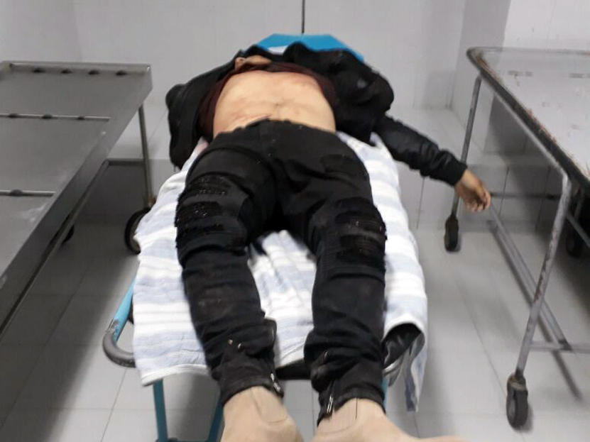 Balean a joven en festividad de Chila; murió en el hospital general de Huajuapan, Oaxaca | El Imparcial de Oaxaca Balean a joven en festividad de Chila; murió en el hospital general de Huajuapan, Oaxaca | El Imparcial de Oaxaca