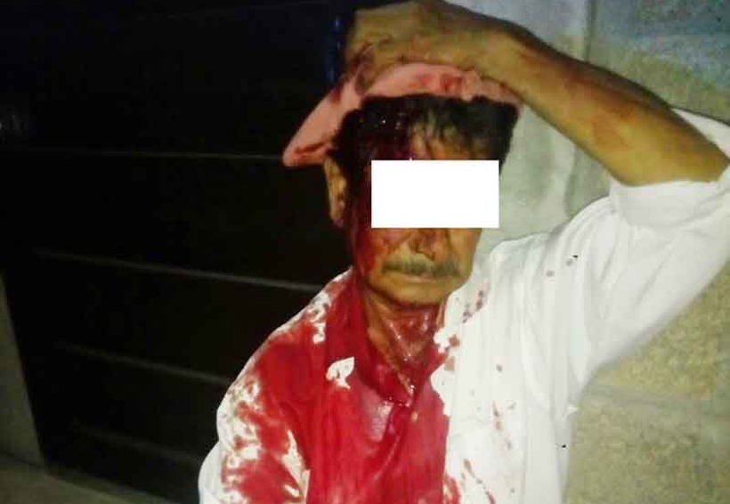 Taxista navajeado por oponerse a un asalto | El Imparcial de Oaxaca Taxista navajeado por oponerse a un asalto | El Imparcial de Oaxaca