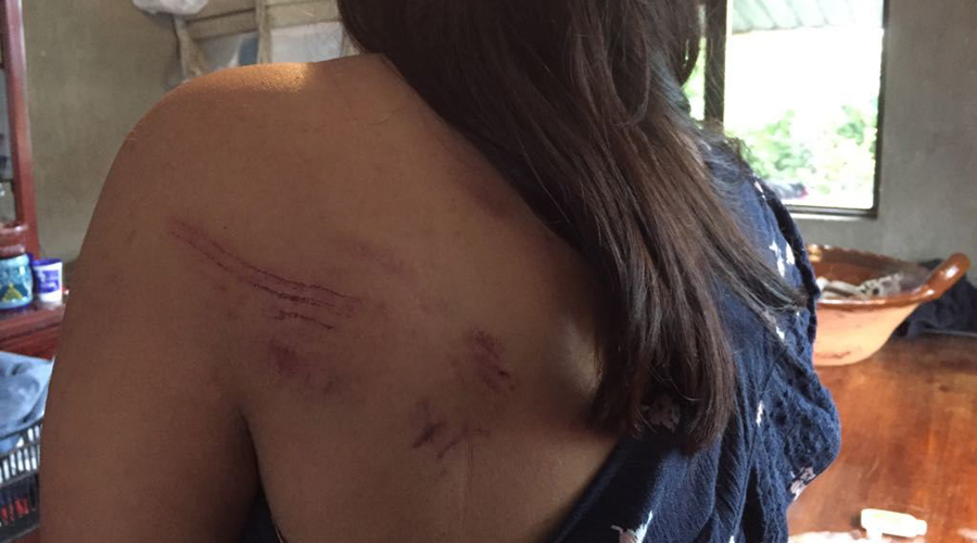 Hospitalizan a una mujer por ataque de una jauría de perros | El Imparcial de Oaxaca Hospitalizan a una mujer por ataque de una jauría de perros | El Imparcial de Oaxaca