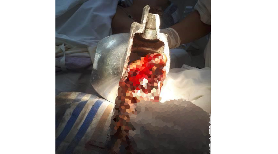 Joven carnicero se tritura la mano en Putla de Guerrero. Noticias en tiempo real