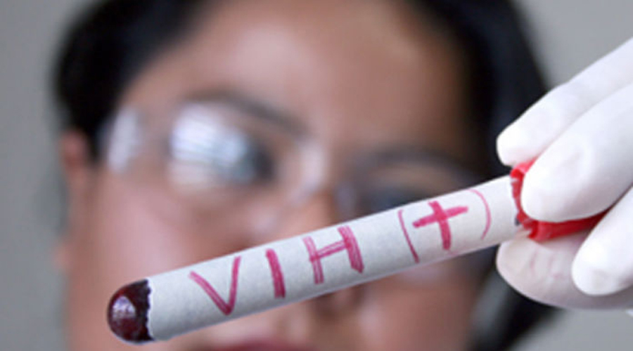 Persiste discriminación contra pacientes con VIH. Noticias en tiempo real