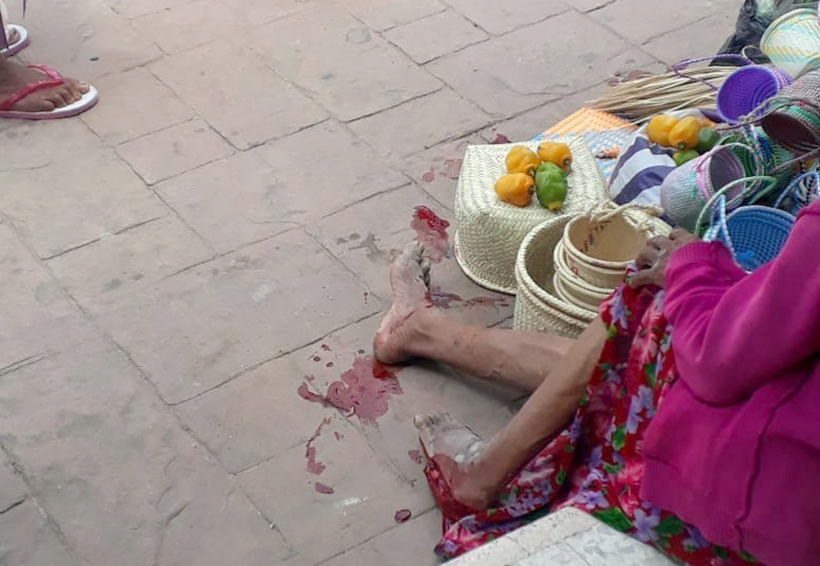Mujer lesionada en Putla de Guerrero. Noticias en tiempo real