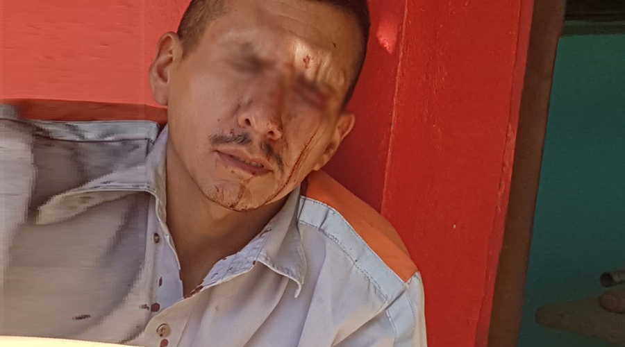 Asaltan a hombre de manera violenta en San Martín Mexicápam. Noticias en tiempo real