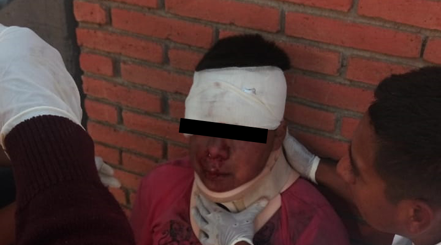 Joven se lesiona cara tras caer de bicicleta en Santa Lucía del Camino. Noticias en tiempo real