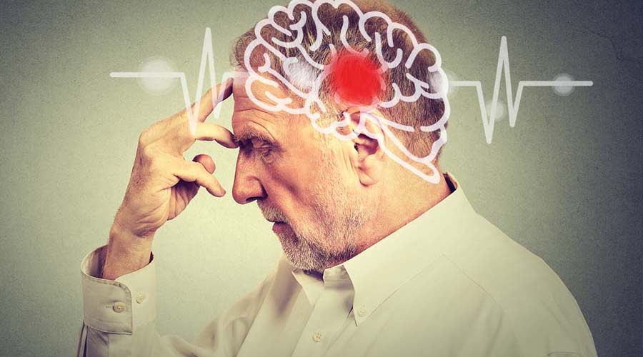 Aumenta a 25% el riesgo de accidente cerebrovascular | El Imparcial de Oaxaca Aumenta a 25% el riesgo de accidente cerebrovascular | El Imparcial de Oaxaca