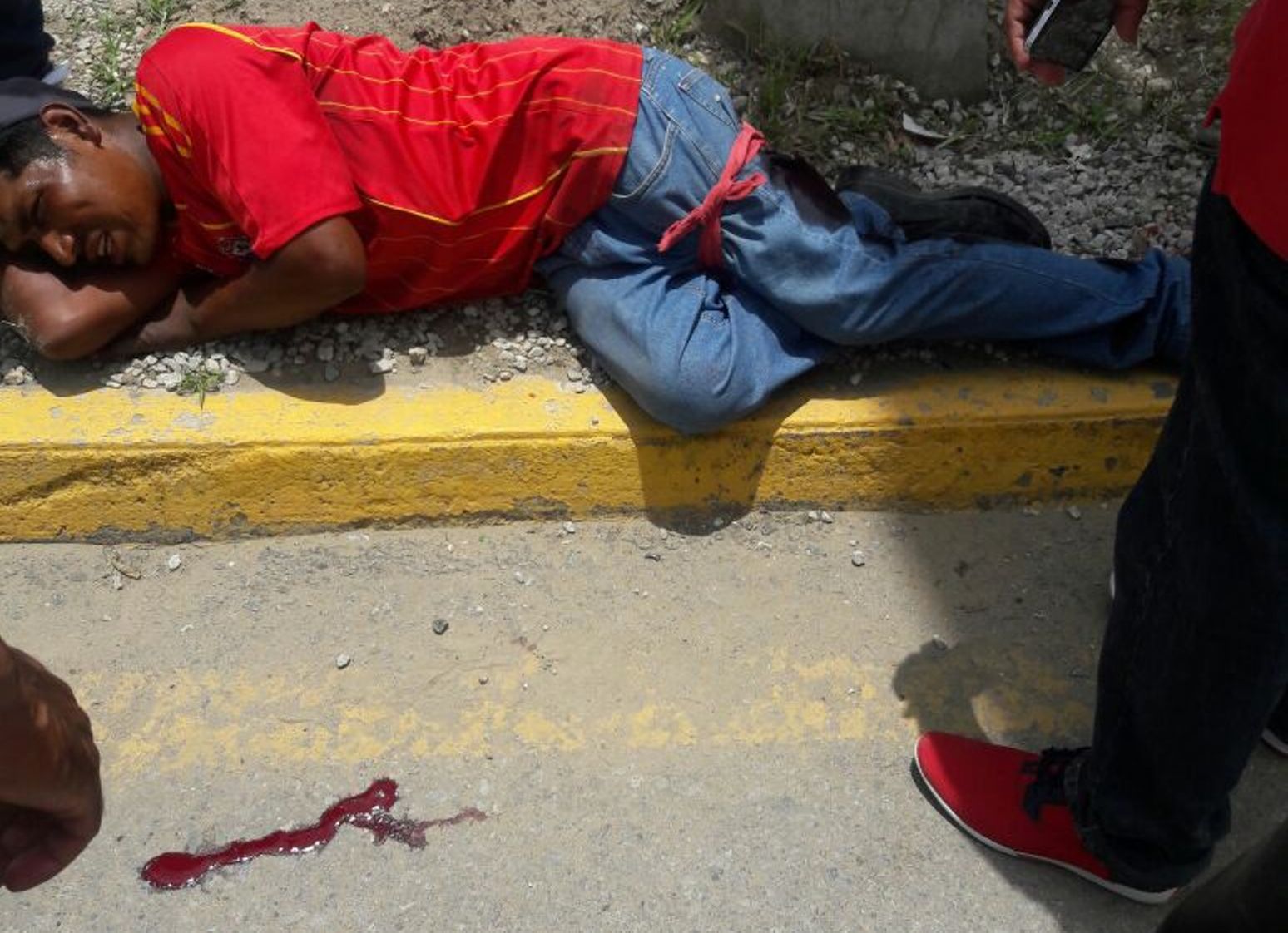Atacan a navajazos a limpiaparabrisas en San Antonio de la Cal | El Imparcial de Oaxaca