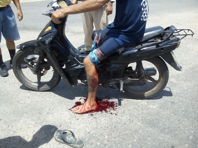 Choca motociclista contra camioneta en Huatulco | El Imparcial de Oaxaca