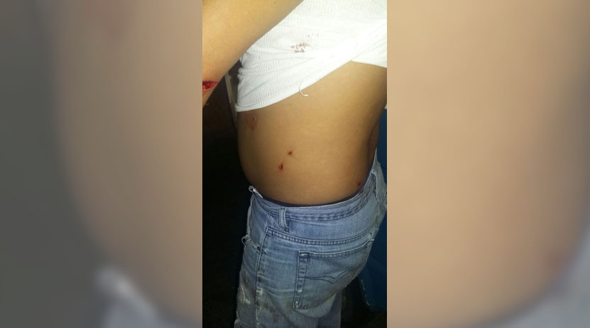 En Juchitán, hieren durante asalto a mototaxista con un picahielo por ‘no traer suficiente efectivo’ | El Imparcial de Oaxaca