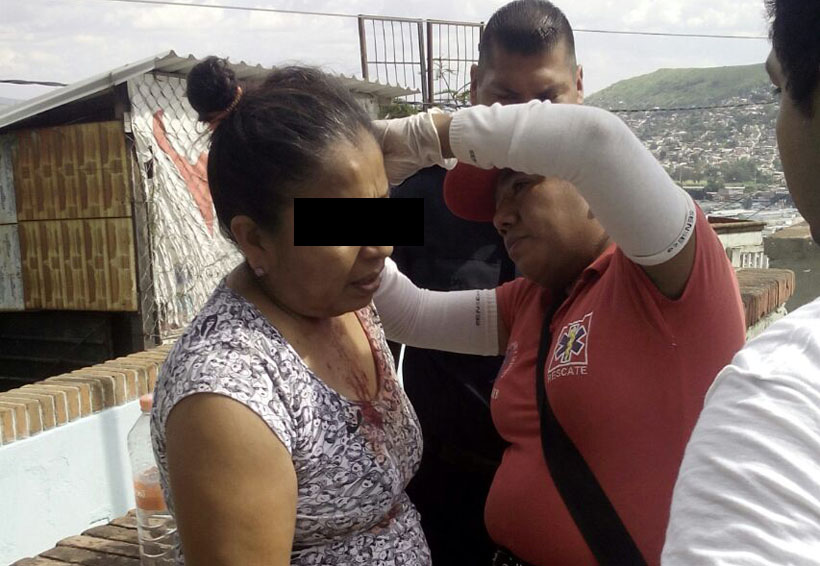 Dos mujeres lesionadas en aparatoso choque en Cerro del Fortín, Oaxaca