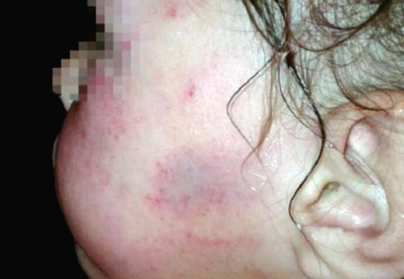 Padrastro golpea a niña de tres años con un palo | El Imparcial de Oaxaca