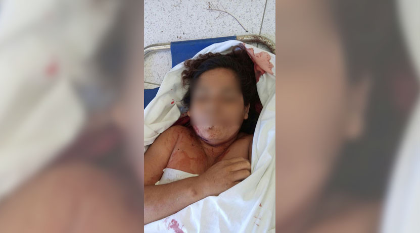 Asesinan de  cuatro balazos  a una mujer en  Miahuatlán de Porfirio Díaz, Oaxaca | El Imparcial de Oaxaca