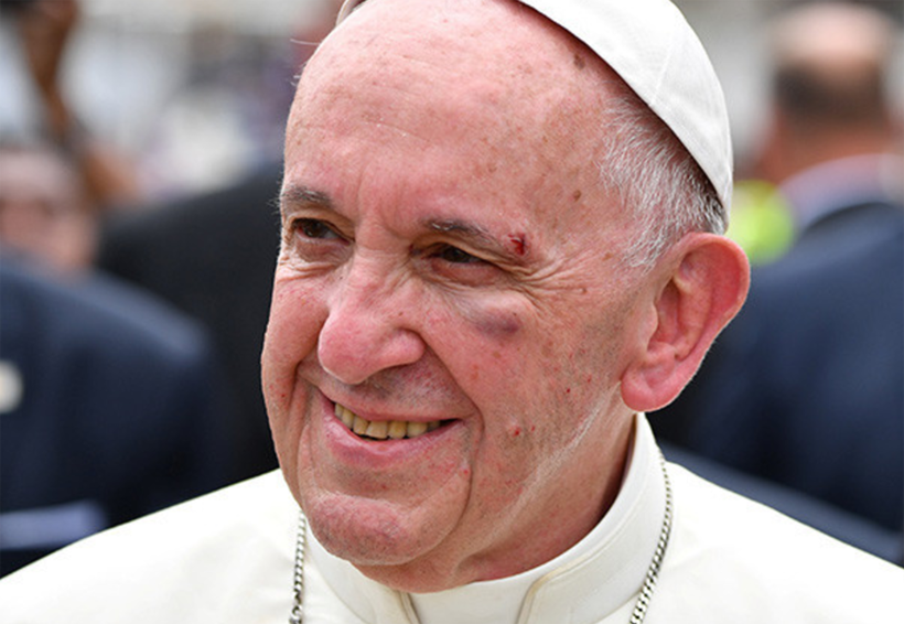 Papa Francisco sufre un golpe en el rostro en papamóvil | El Imparcial de Oaxaca