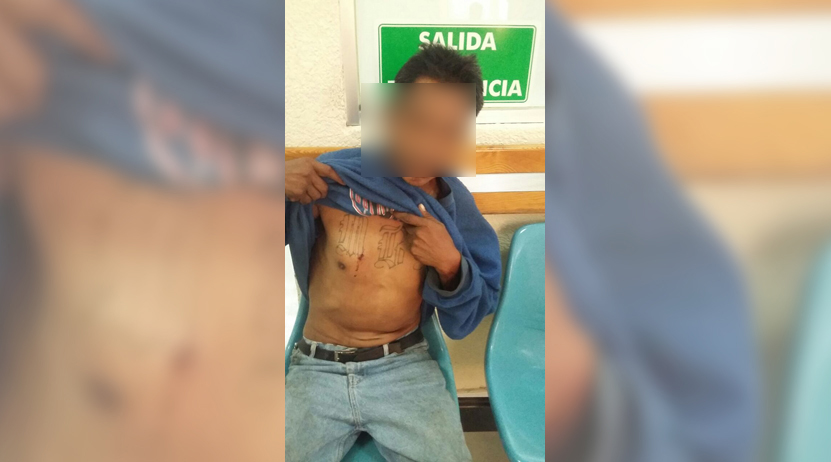 Atacan a joven en Central de Abasto | El Imparcial de Oaxaca