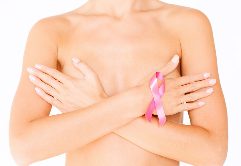 Las cicatrices del cáncer de mama
