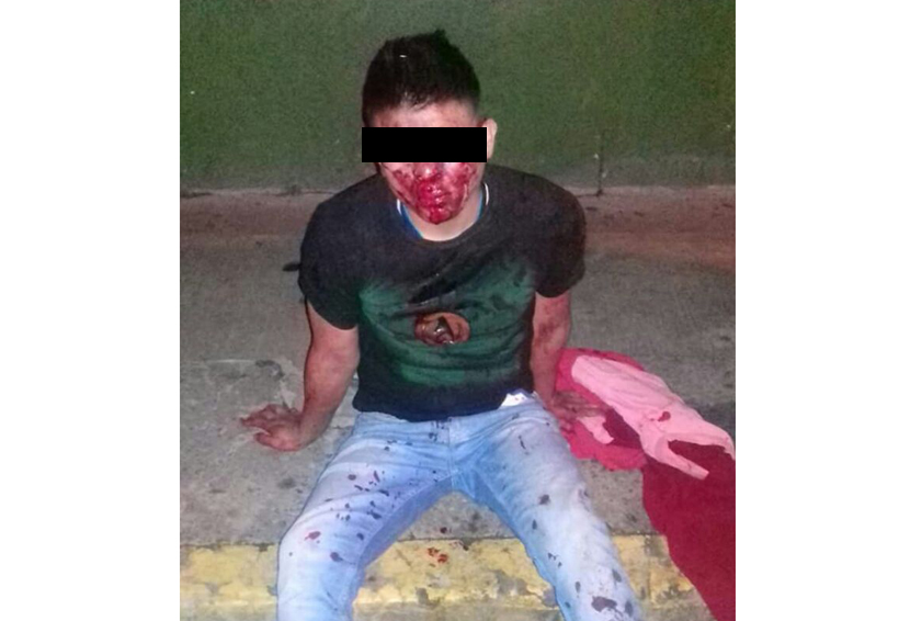 Golpean a joven en céntrico bar de la ciudad de Oaxaca | El Imparcial de Oaxaca