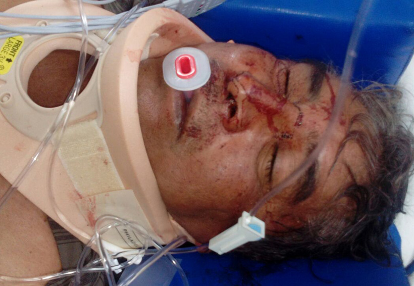 Cae de caballo y queda inconsciente en San Isidro, Etla | El Imparcial de Oaxaca