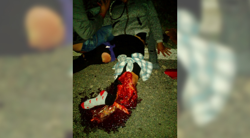 Grave, al derrapar en moto en Río Grande, Tututepec, Oaxaca