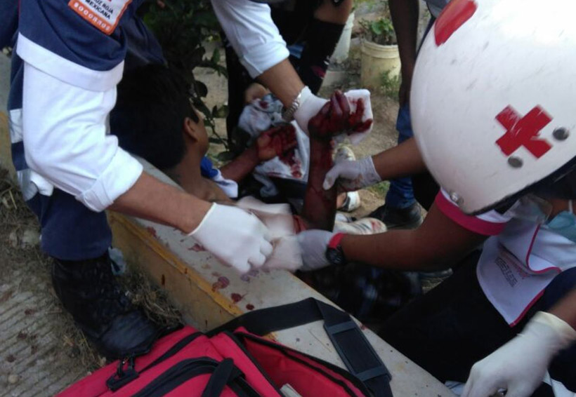 En Oaxaca, atacan a joven a machetazos por ahuyentar a un perro a pedradas | El Imparcial de Oaxaca