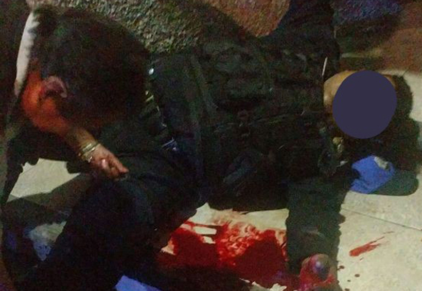 Policía intenta frustrar asalto y sale herido | El Imparcial de Oaxaca