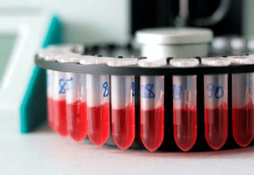 Crean método de detección en sangre de cáncer | El Imparcial de Oaxaca