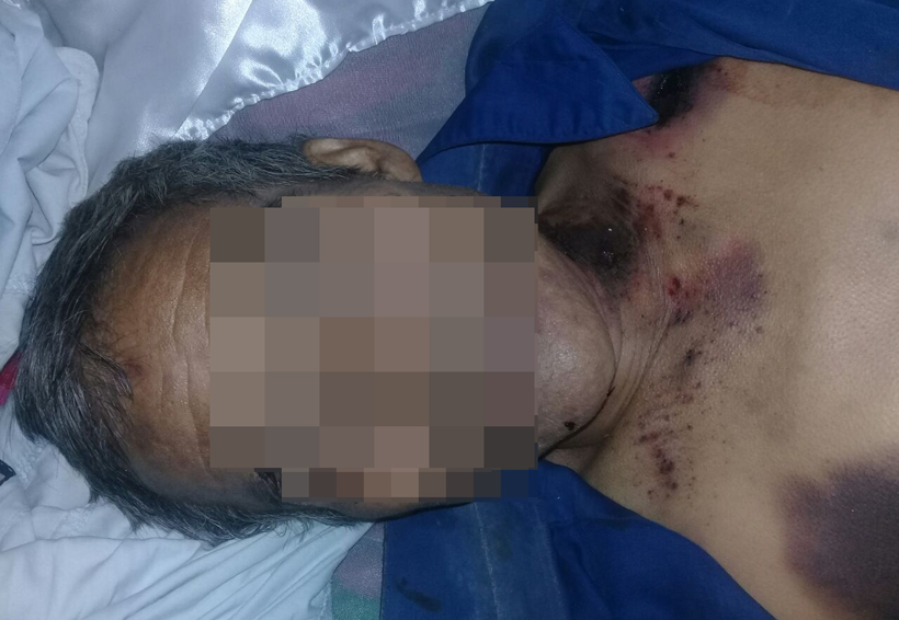 Asesinado a balazos en Río Metates, Copala; sospechan parricidio | El Imparcial de Oaxaca