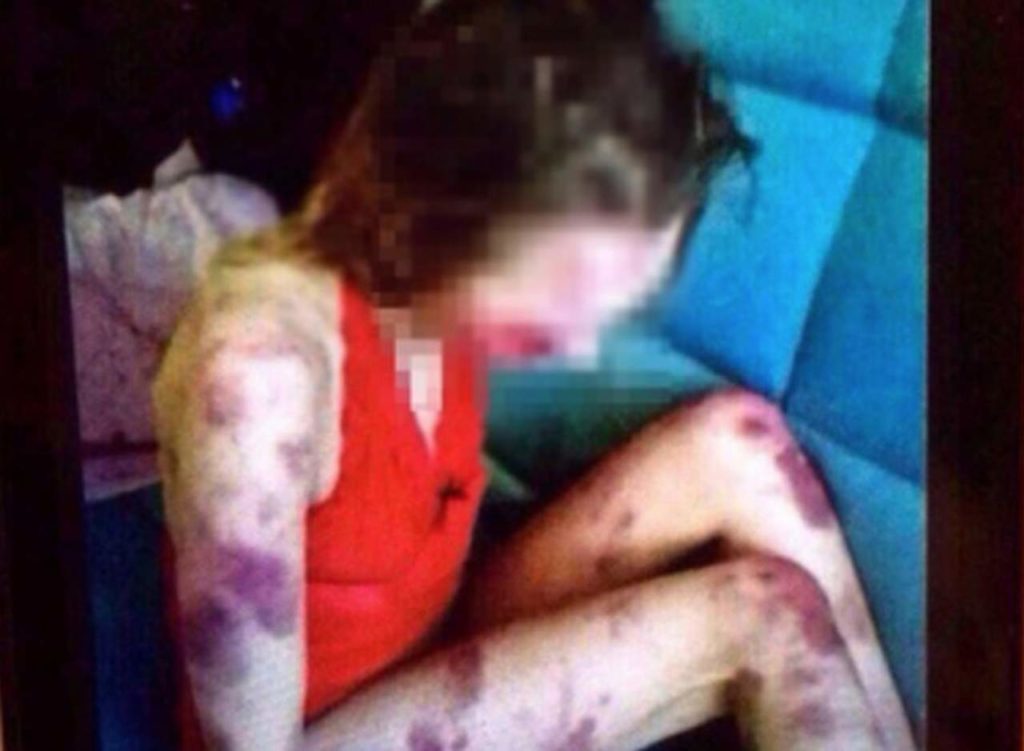 Indignación por caso de un hombre que golpeó hasta la muerte a su amante | El Imparcial de Oaxaca Indignación por caso de un hombre que golpeó hasta la muerte a su amante | El Imparcial de Oaxaca