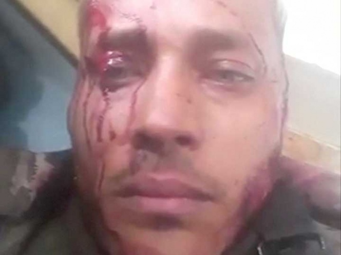 Policía rebelde de Venezuela murió por tiro en la cabeza | El Imparcial de Oaxaca