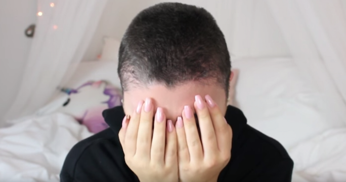 Una YouTuber pierde todo su cabello por usar producto capilar sin leer las instrucciones | El Imparcial de Oaxaca