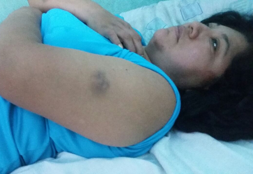 Ante la presencia de autoridades y  policías la golpean en Mixtepec, Oaxaca | El Imparcial de Oaxaca
