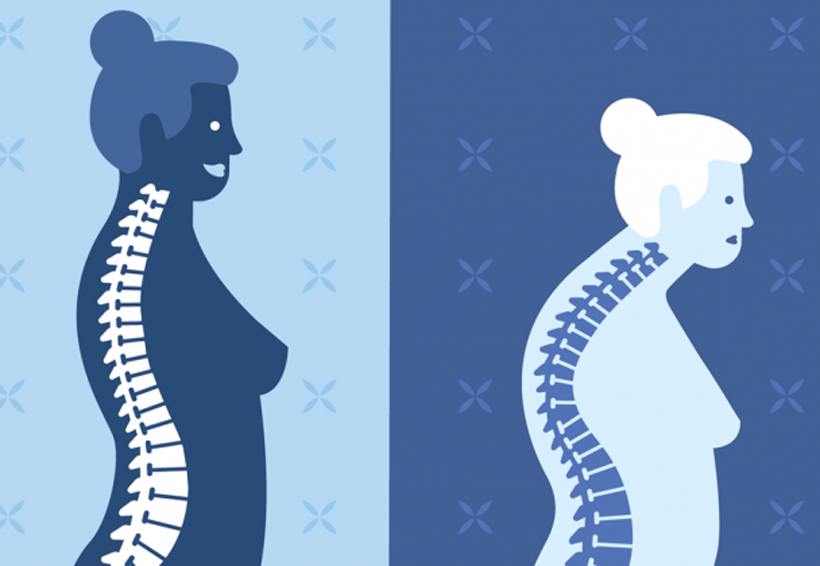 50% de fracturas serán por osteoporosis | El Imparcial de Oaxaca