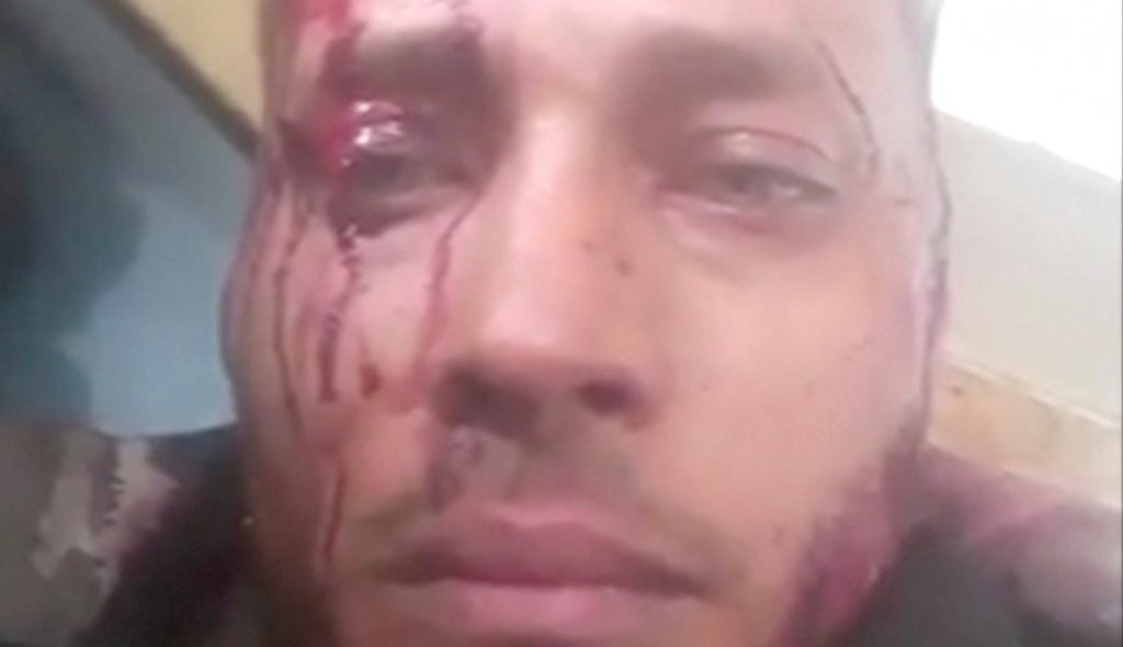 Muerte de Oscar Pérez aviva denuncias sobre violación de derechos humanos en Venezuela