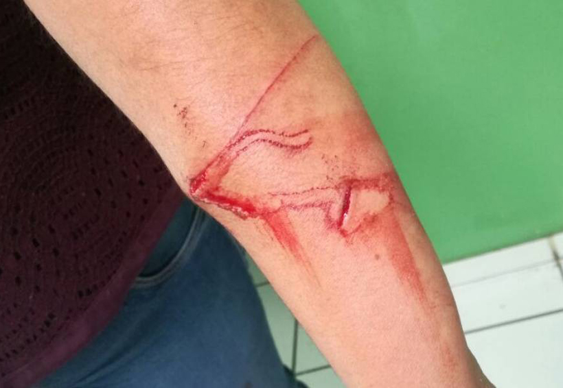 Niño de 10 años ataca con su cuchillo a su maestra en una escuela de Tonalá | El Imparcial de Oaxaca