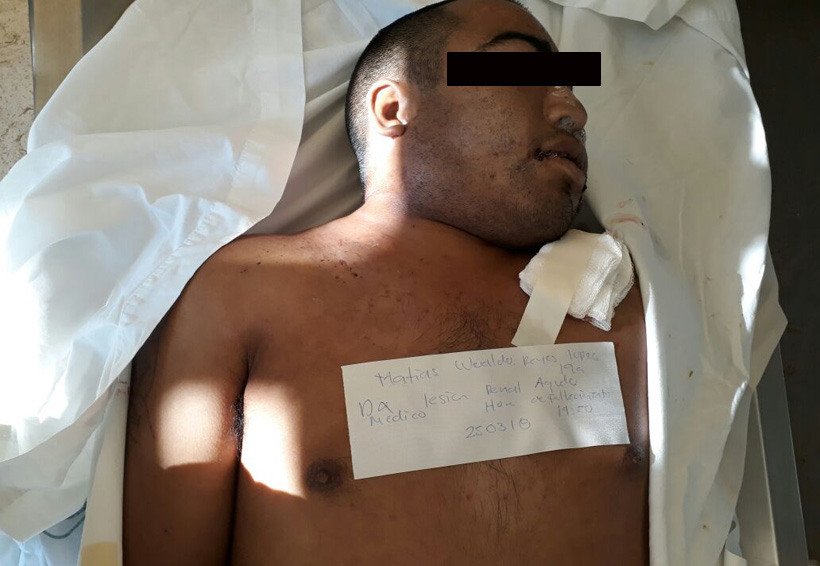 Joven muere tras ser recluido en anexo de Miahutlán, Oaxaca | El Imparcial de Oaxaca