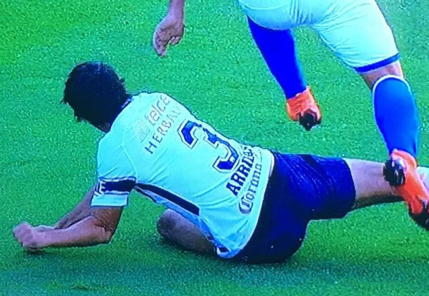 Alejandro Arribas sufrió lesión en el codo en el duelo entre  Pumas y Cruz Azul | El Imparcial de Oaxaca