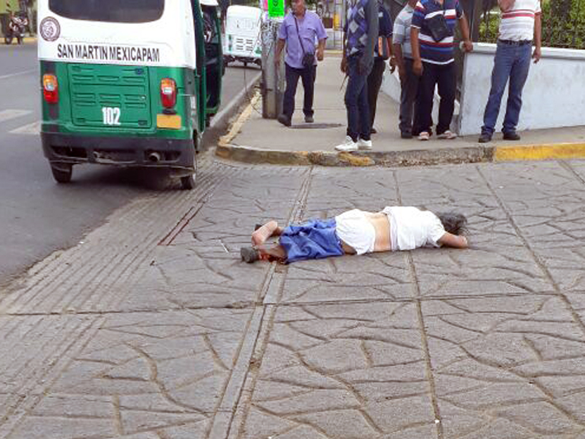 Urbano arrolla a mujer y le destroza la pierna | El Imparcial de Oaxaca