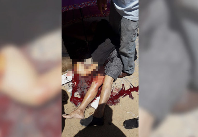 Inexperta conductora deja sin brazo a mujer en Xoxocotlán, Oaxaca