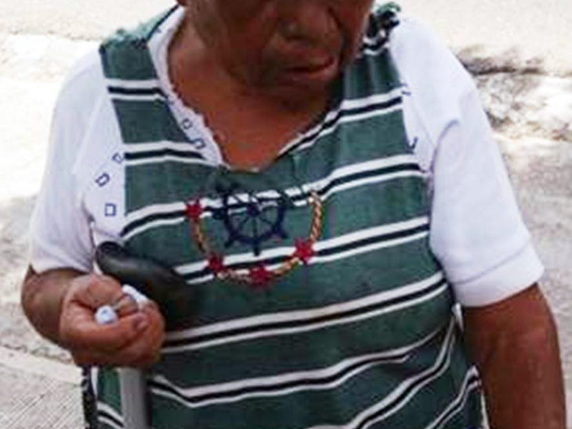Perro sale de una casa y ataca a anciana; le muerde las manos