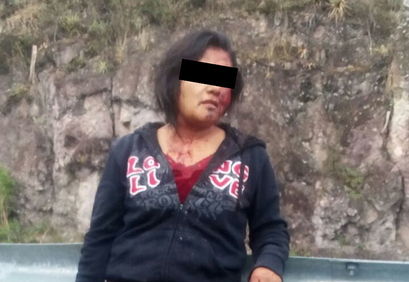 Luego de accidente de auto, mujer se reporta grave | El Imparcial de Oaxaca