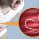 ¿Tienes parásitos intestinales? Elimínalos de forma natural