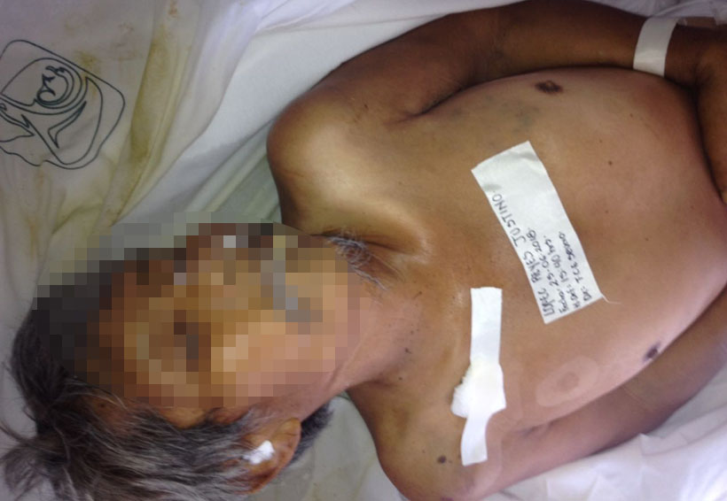 Investigan muerte de hombre de  70 años de edad en Cozoaltepec, Oaxaca | El Imparcial de Oaxaca