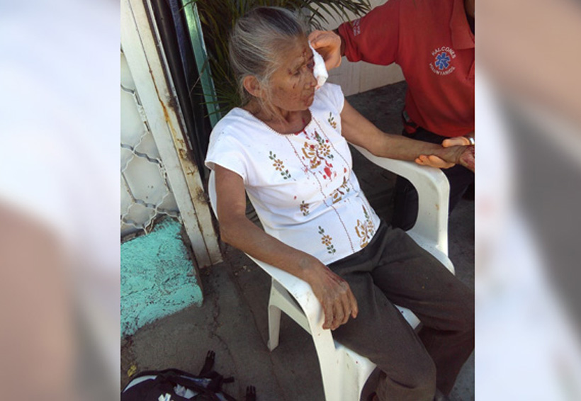 Veloz vehículo arrolla a mujer de 73 años en la colonia Cuahutemoc, Oaxaca | El Imparcial de Oaxaca