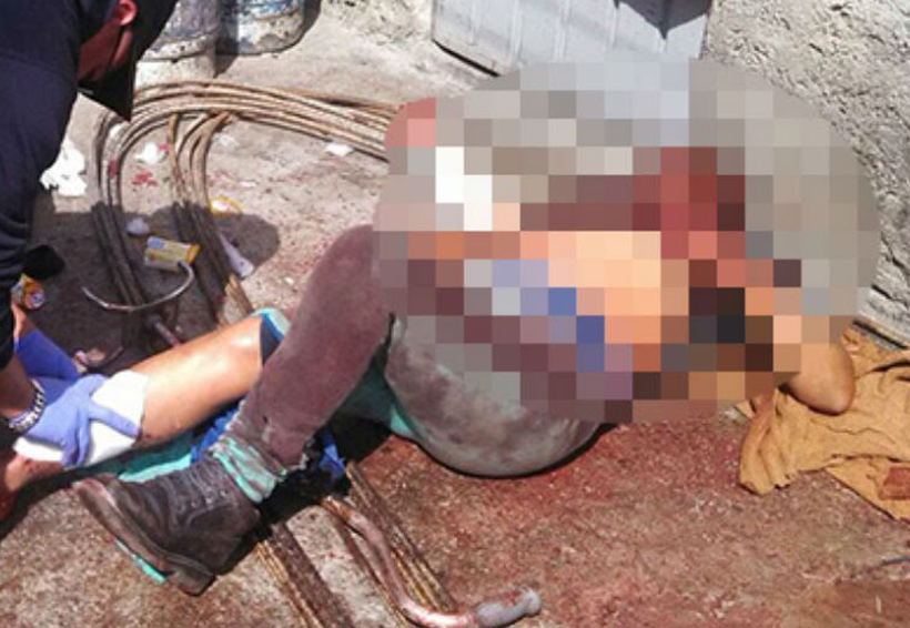 Perros pitbull atacan a una mujer