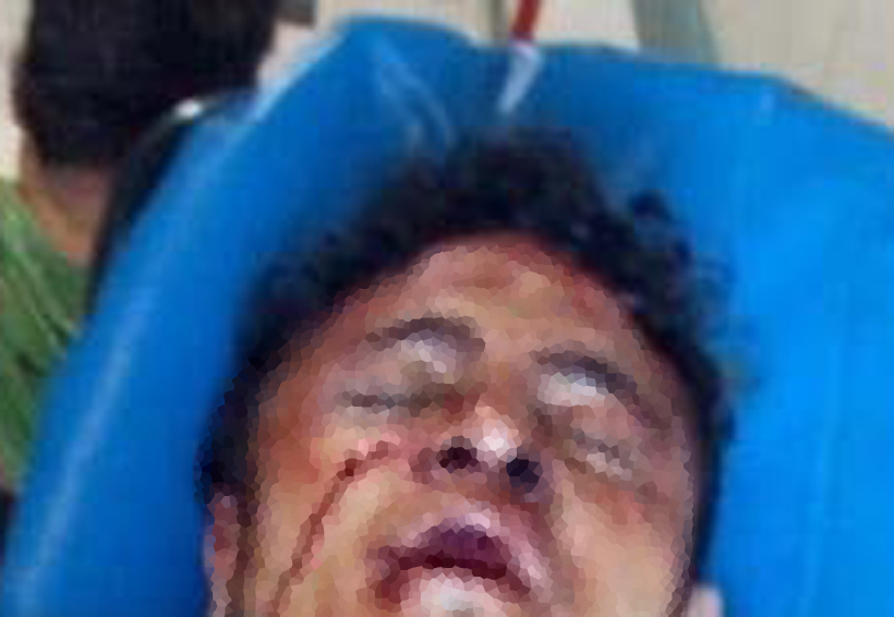Vecinos dejan moribundos a golpes a dos ladrones