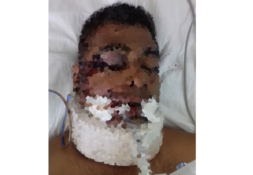 Grave hombre  embestido en  su motocicleta | El Imparcial de Oaxaca