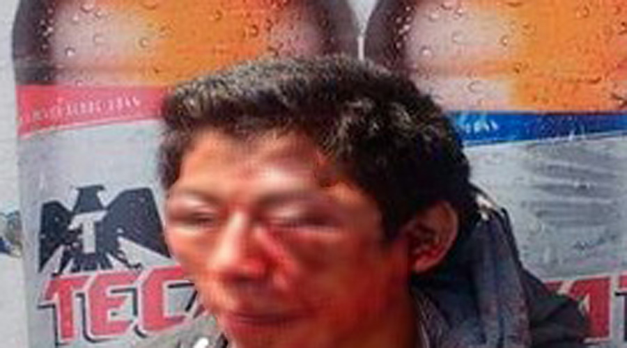Asaltante termina desfigurado al recibir una paliza por parte de vecinos | El Imparcial de Oaxaca
