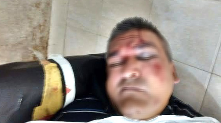 Hombre muere luego de recibir una golpiza y negarse a ser hospitalizado | El Imparcial de Oaxaca